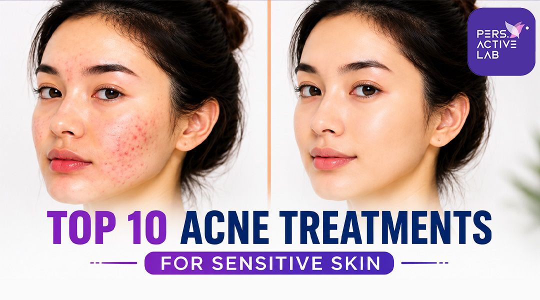 Top 10 Acne Treatments for Sensitive Skin: Avoiding Irritation While Healing